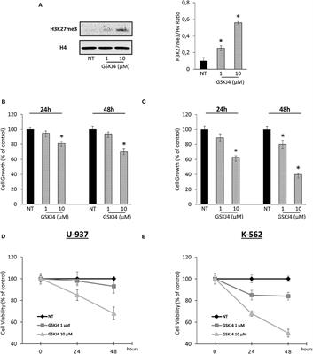 The KDM Inhibitor GSKJ4 Triggers CREB Downregulation via a Protein Kinase A and Proteasome-Dependent Mechanism in Human Acute Myeloid Leukemia Cells